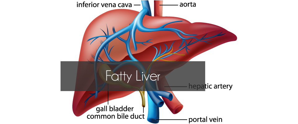 Fatty Liver Disease – The Silent Epidemic